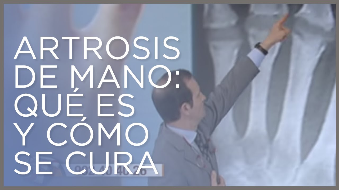 se puede trabajar con artrosis en las manos