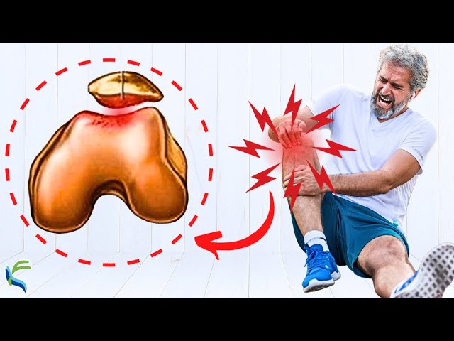 se puede trabajar con condromalacia rotuliana