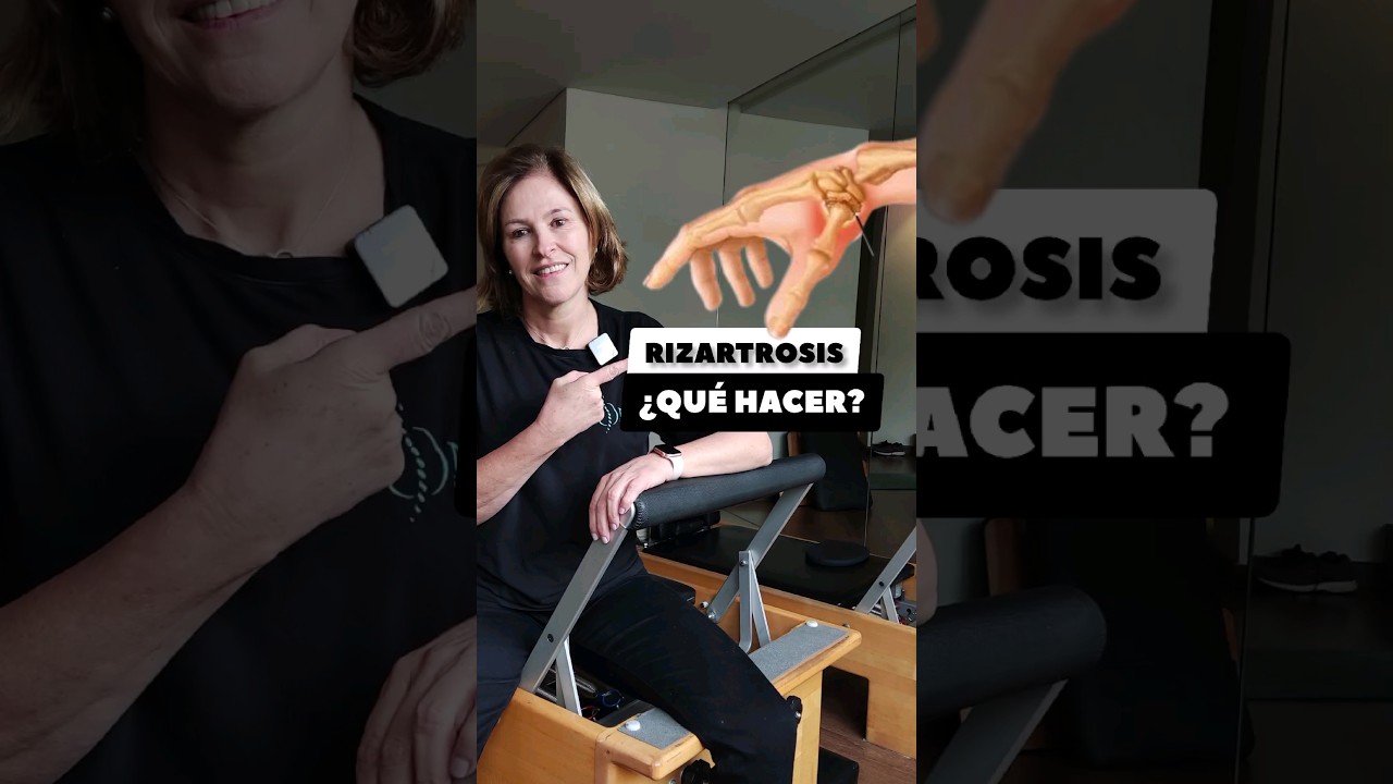 tiempo de baja por rizartrosis pulgar izquierdo