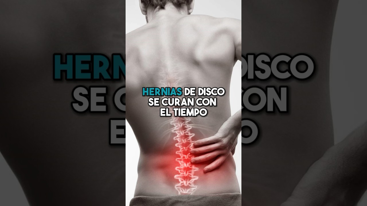tiempo de baja por hernia discal