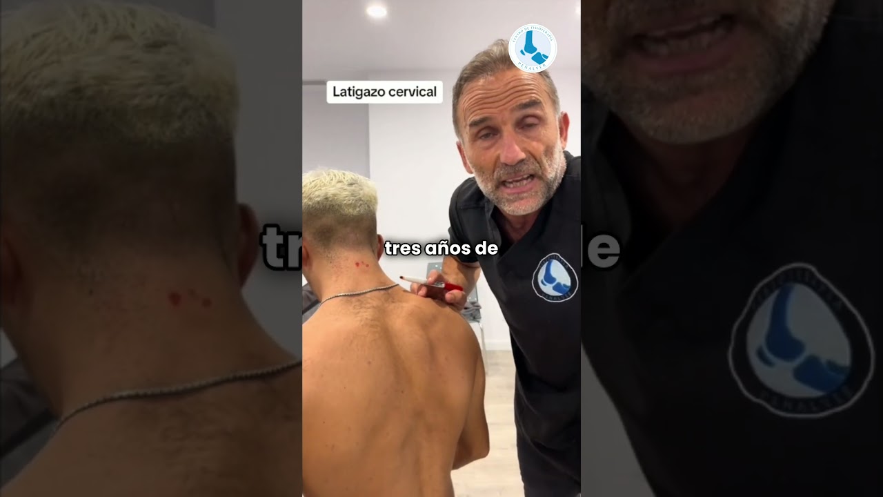 puntos de secuela por cervicalgia y lumbalgia