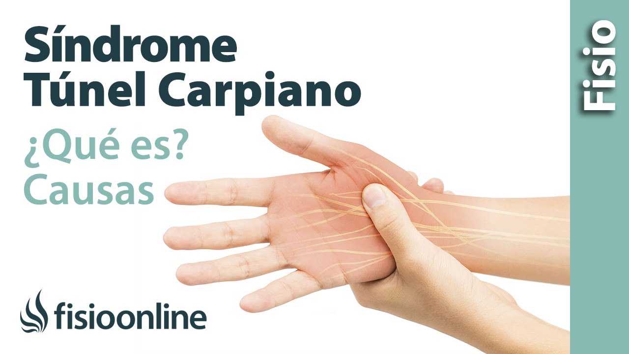 se puede trabajar con el síndrome del túnel carpiano