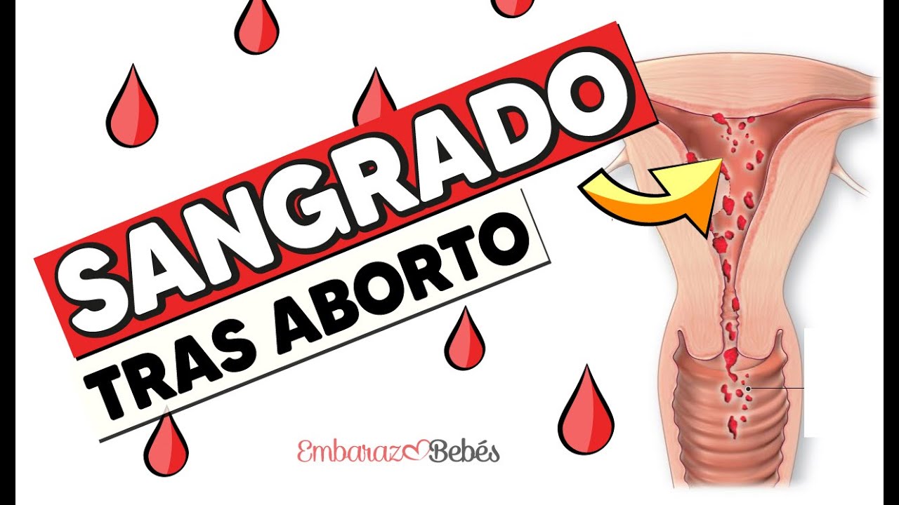 cuantos dias de baja por aborto natural